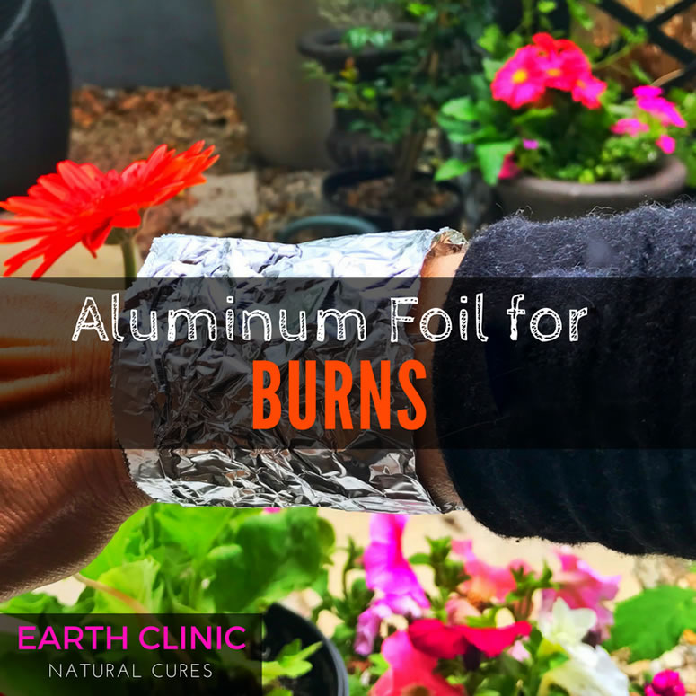 Aluminum Foil for Burns