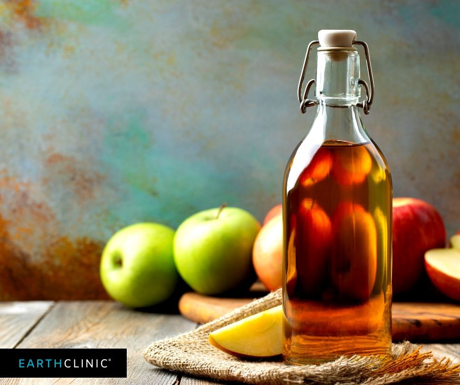 Apple Cider Vinegar Remedy on Earth Clinic.