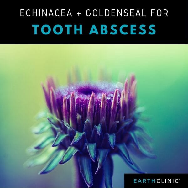 Echinacea and Goldenseal for Tooth Abscess.