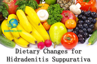 Hidradenitis Suppurativa Dietary Changes