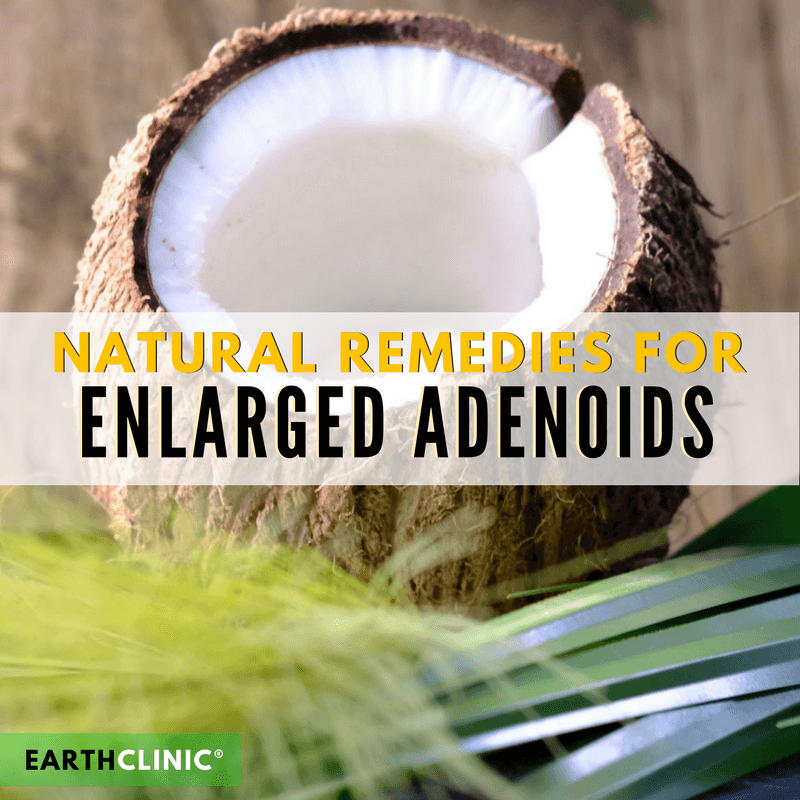 Enlarged Adenoids Natural Remedies