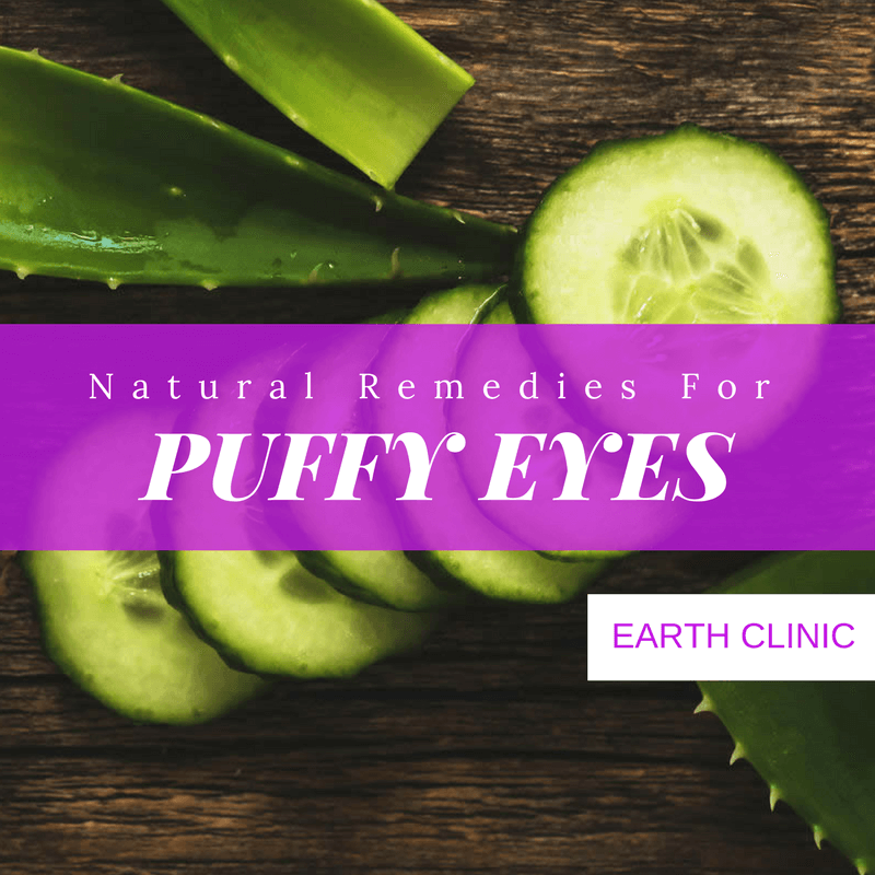 Puffy Eye Natural Remedies