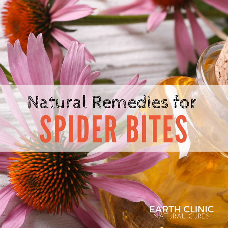 Spider Bite Natural Remedies