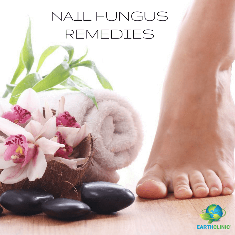 Colloidal Silver For Toenail Fungus Ecis