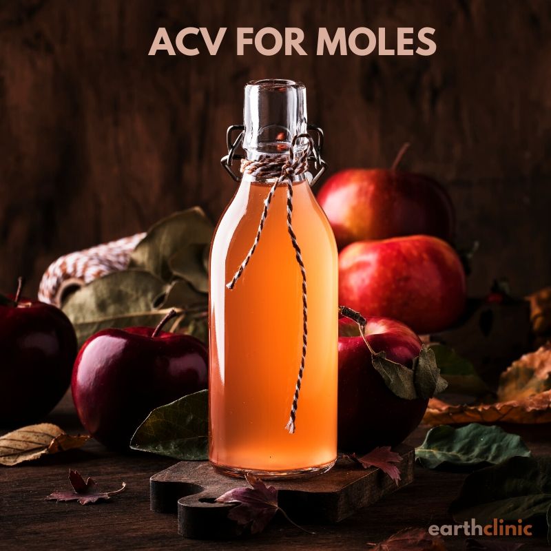 Apple Cider Vinegar for Moles