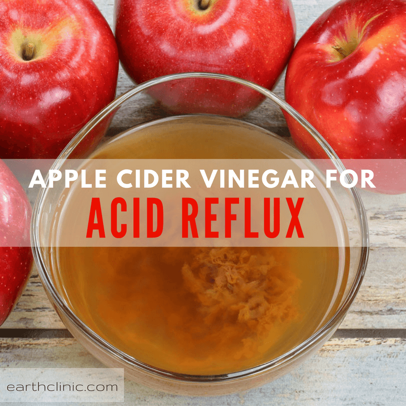 Apple Cider Vinegar for Acid Reflux