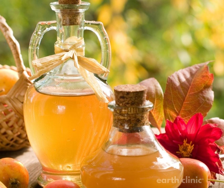 Apple Cider Vinegar Remedy.