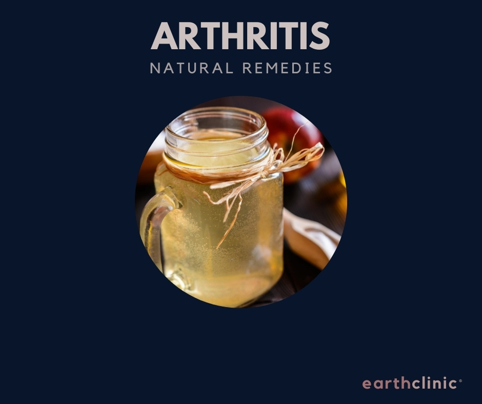 Natural remedies for arthritis on Earth Clinic.