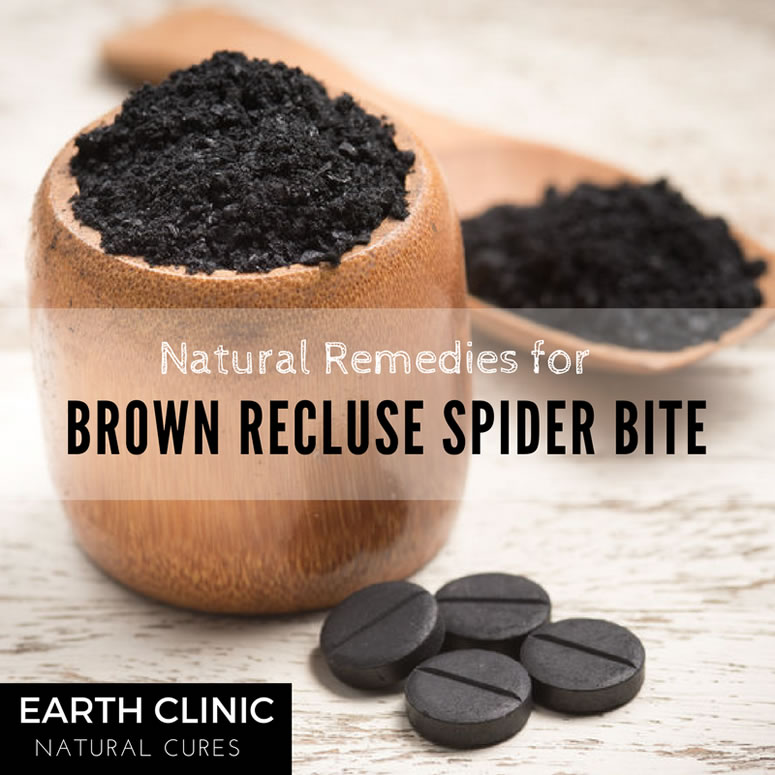 Brown Recluse Spider Bite Remedies
