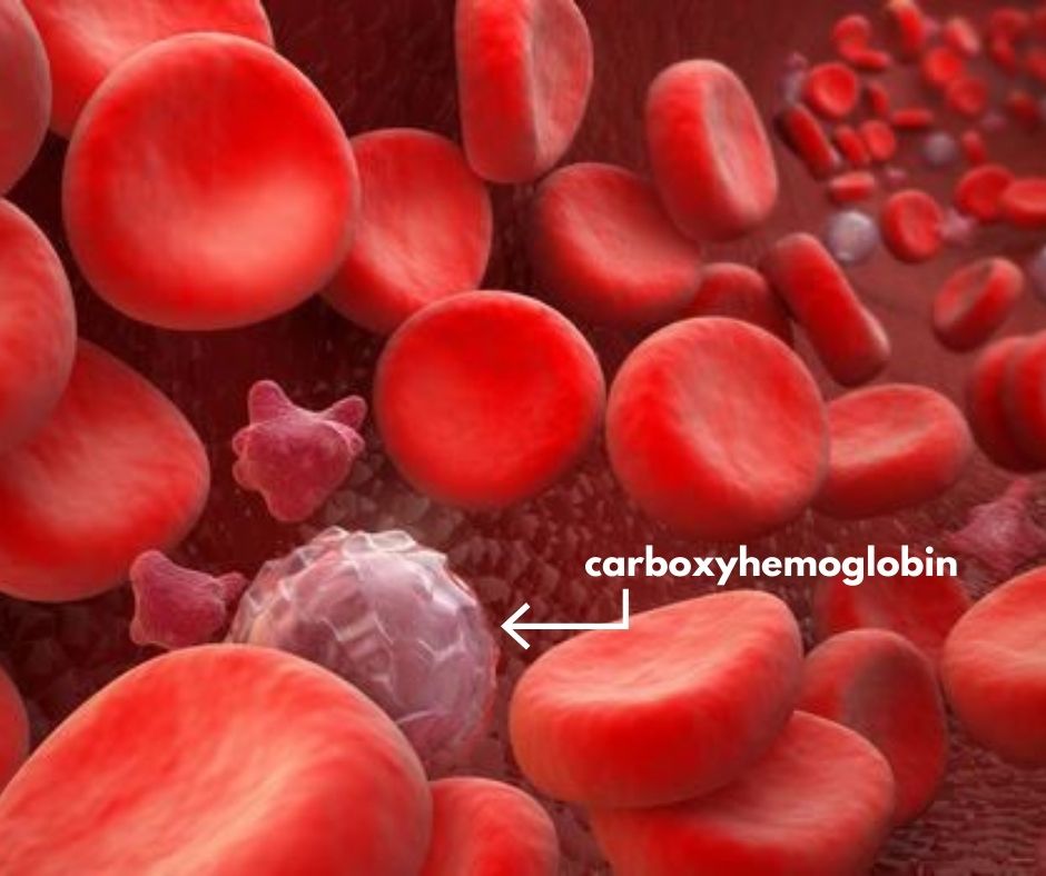 carboxyhemoglobin