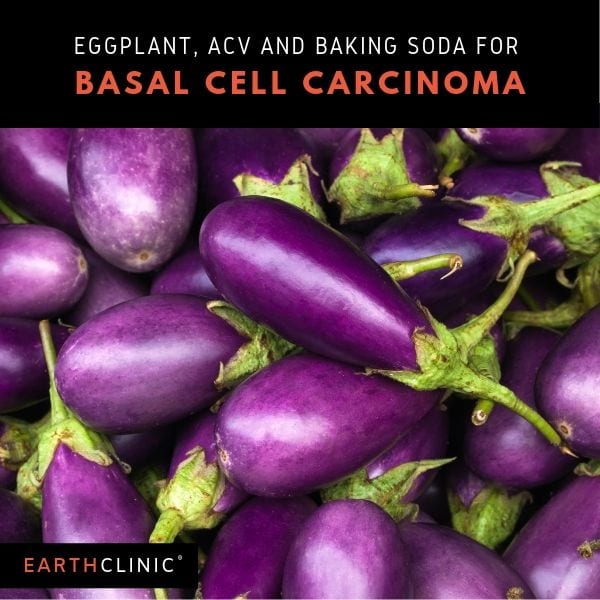 Eggplant, ACV and Baking Soda for BCC.