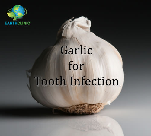 Garlic for Tooth Infection