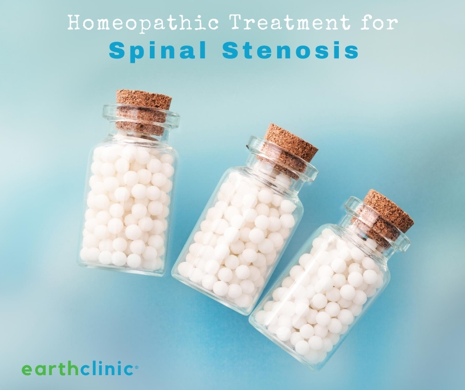 Spinal Stenosis Homeopathic Protocol