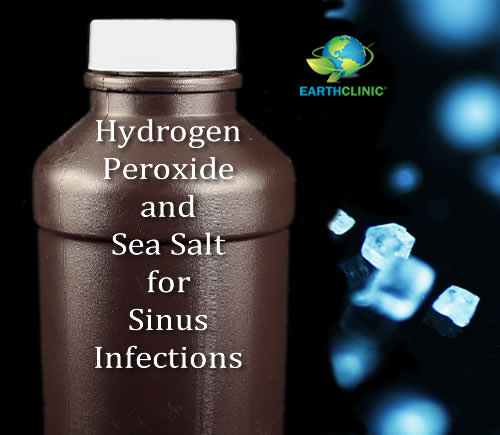 Hydrogen Peroxide and Sea Salt Sinus Infection Treatment