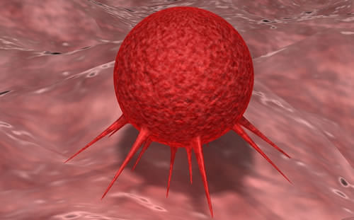 Immunotherapy for Cervical Cancer
