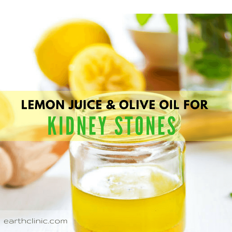 Lemon Juice and Olive Oil for Kidney Stones