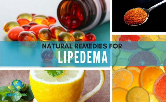 Lipedema Natural Remedies