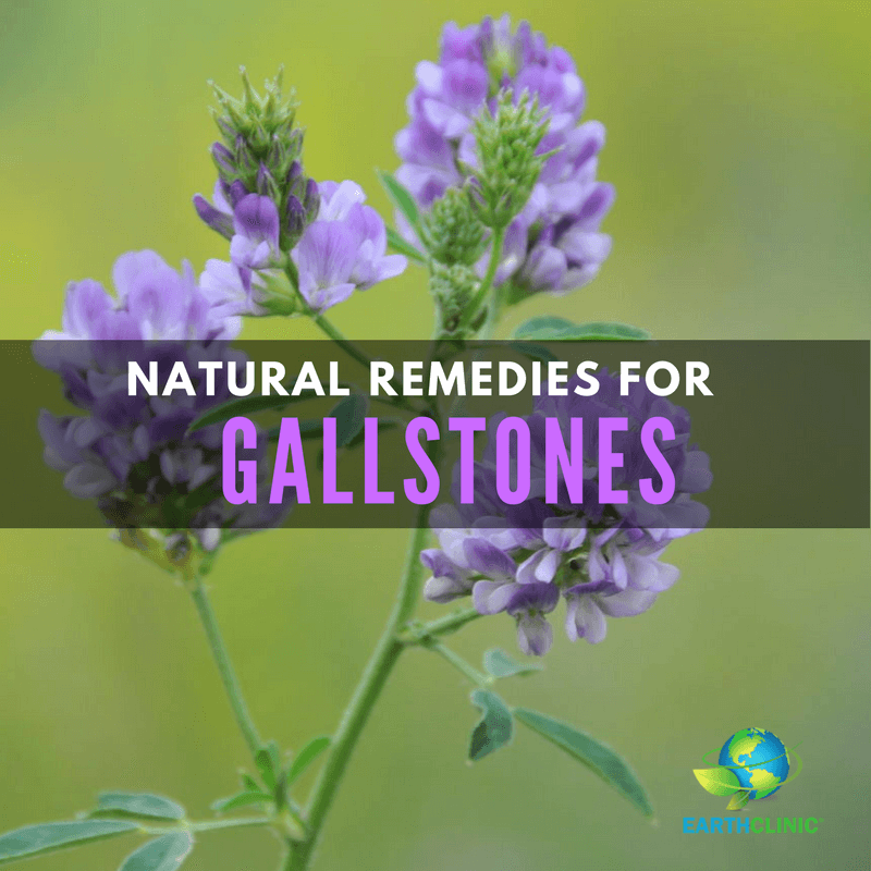 Natural Remedies for Gallstones