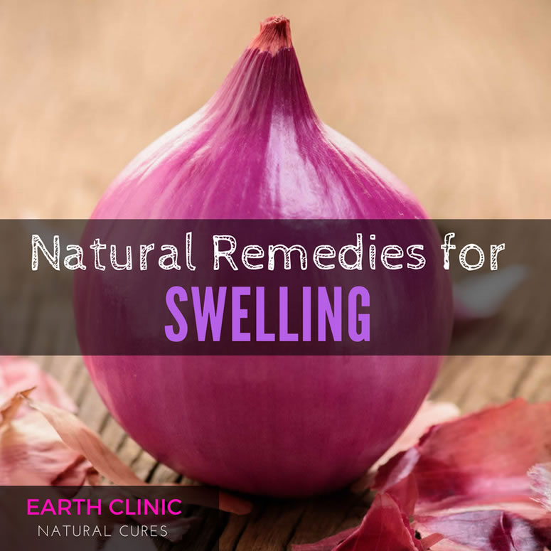 Natural Remedies for Injury Swelling