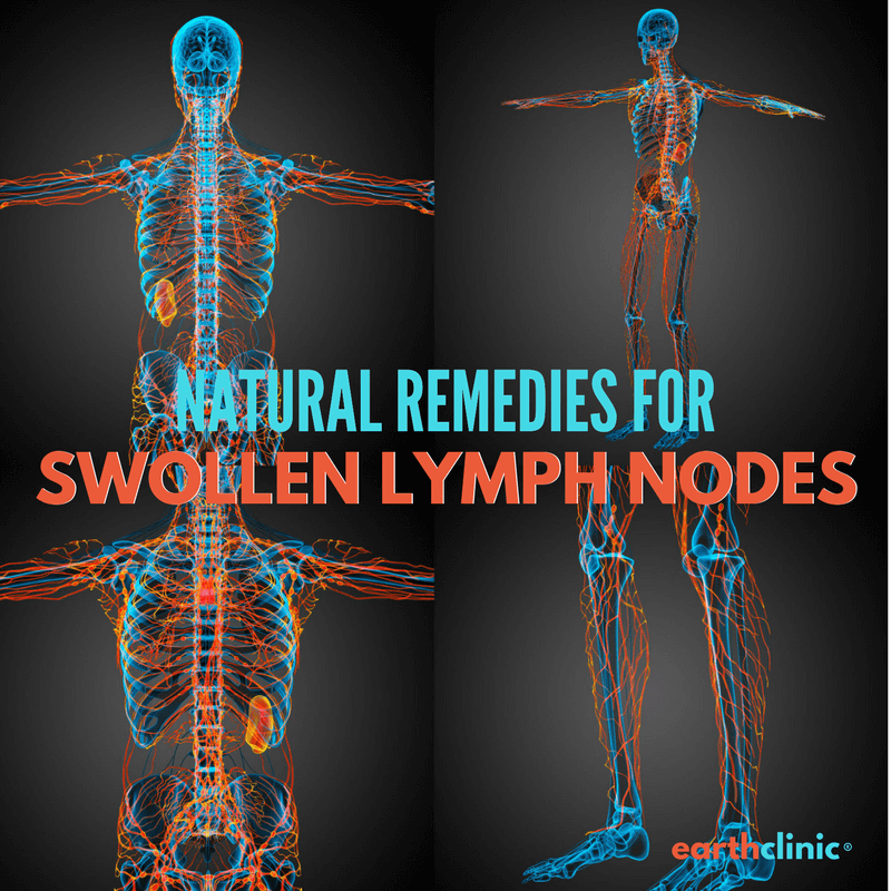 Lymph remedies nodes swollen for Swollen lymph