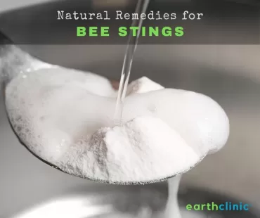 Bee Sting Remedies